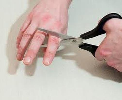 fingers cut