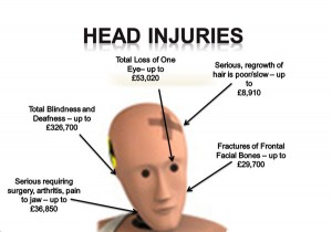 signs of head trauma